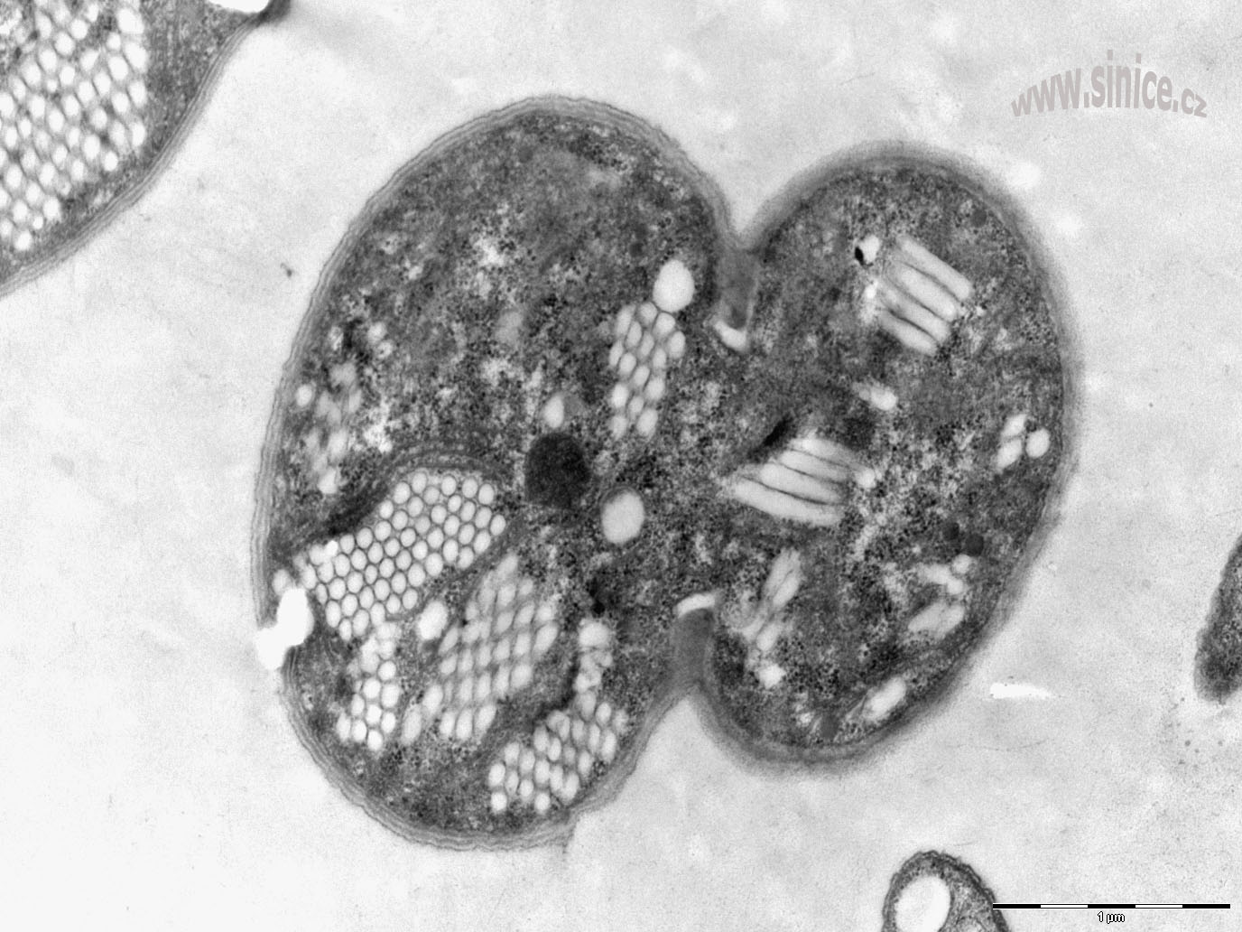 Microcystis - elektronová mikroskopie