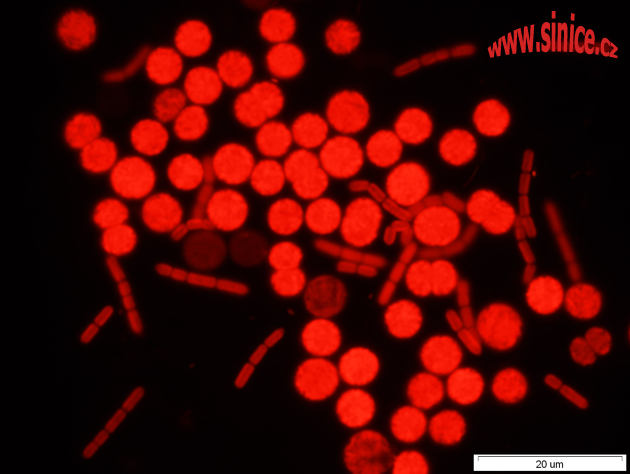 cyanobacterial autofluorescence