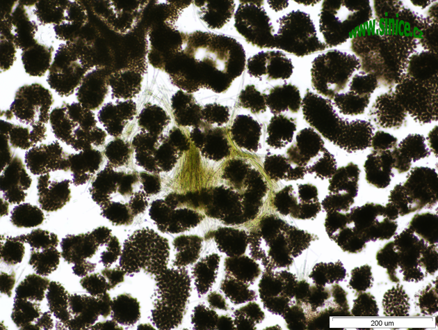 cyanobacterial colonies - light microscopy