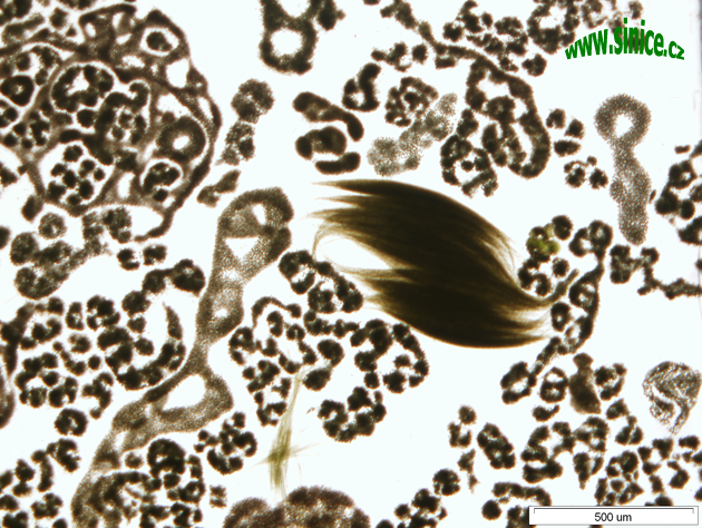 kolonie sinic - světelná mikroskopie